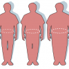 Obesity-waist_circumference1